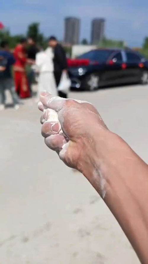 女子睡觉时被虫咬断一大把头发
